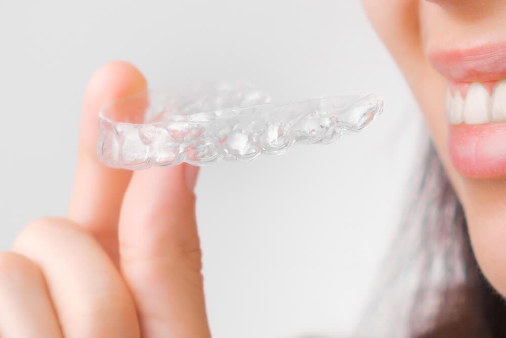 Invisalign Clear Aligners in Greenbelt MD Area