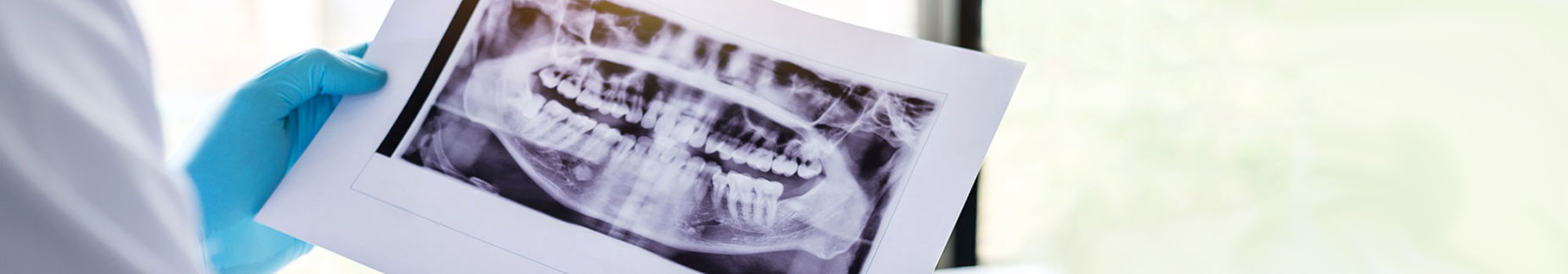 A dentist checking a dental X-ray